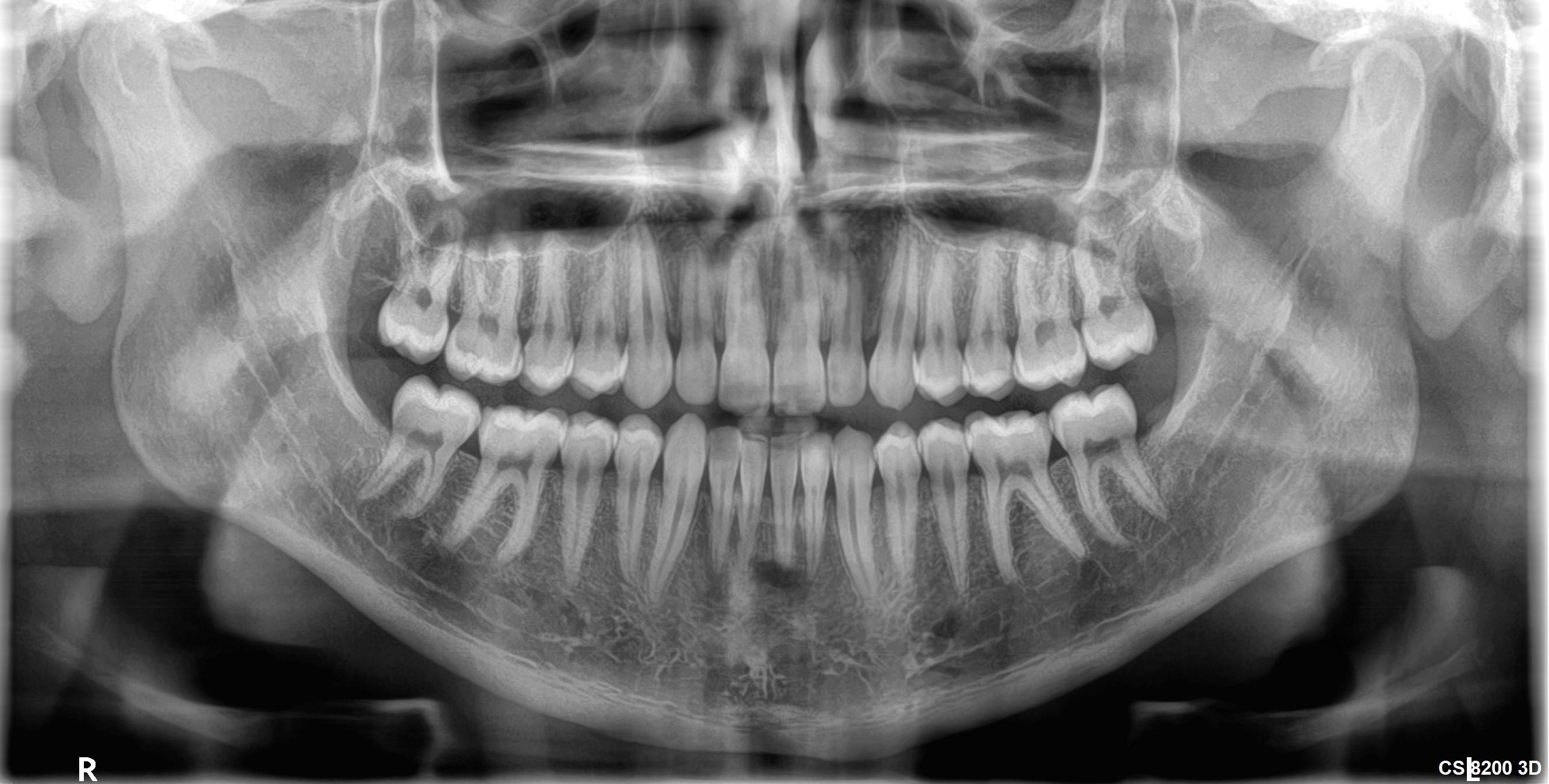 X-ray images in dentistry